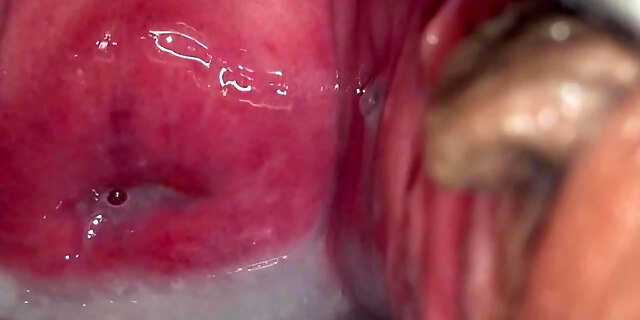 Cervix